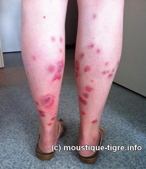 http://moustique-tigre.info/wp-content/uploads/2014/05/moustique-tigre.jpg
